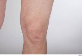 Sigvid knee nude 0003.jpg